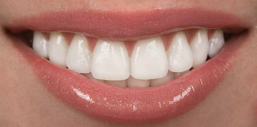 Are Porcelain Veneers Right For Me?
